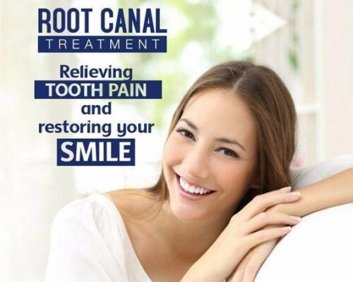 The Role of Root Canal Treatment in Preserving Your Natural Smile