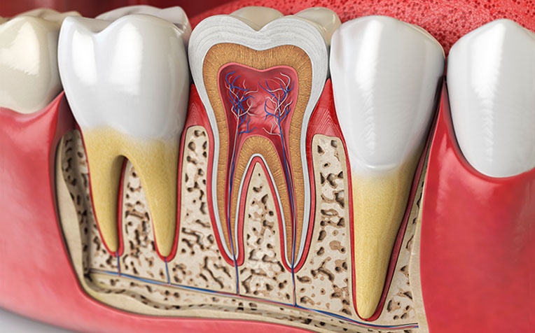Root Canal Treatment in Sangvi