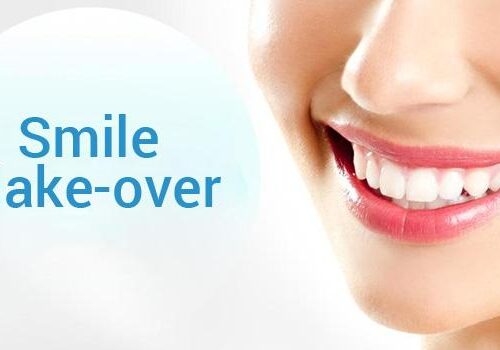 How a Smile Makeover Creates a Positive Impact on Your Life – Grace Clinic Dental Skin Hair and Laser